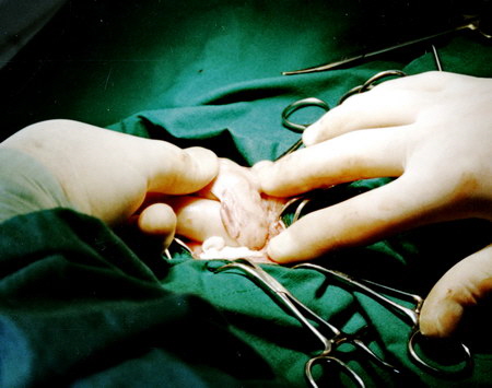 Kleinschnitt Technik ist keine laparoskopische Kastration und nicht minimalinvasiv