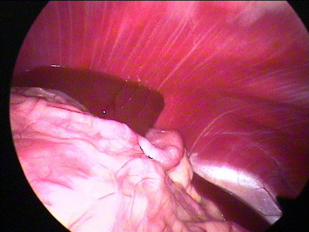 Laparaskopie Hund Blick auf Zwerchfell (Diaphragma)