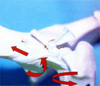 Unterstützungsband nach Meij bei DBO Unterstützungsband nach Meij bei DBO