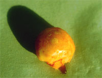 HD  und Coxarthrose Knorpeldefekt HD  und Coxarthrose Knorpeldefekt