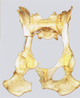 DBO am Knochenmodell DBO am Knochenmodell