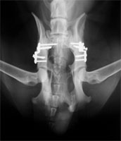 DBO Komplikation Schraubenlockerung DBO Komplikation Schraubenlockerung