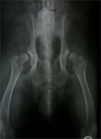 HD vollständige Luxation  HD vollständige Luxation