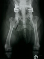 DBO bilateral Ausheilungsergebnis DBO bilateral Ausheilungsergebnis