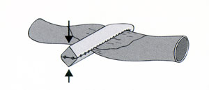 Abb-4--Clip-perfekt-geschlo