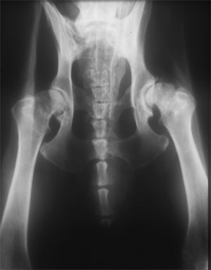 Abb-5-Coxarthrose