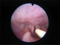 Abb 15 Mandrin-vor-Rima Abb 15 Mandrin-vor-Rima