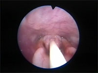 Abb 16 Mandrin-überwindet-Rima Abb 16 Mandrin-überwindet-Rima