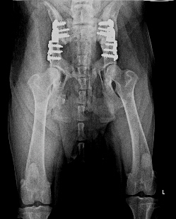 Ergebnis nach beidseitger DBO Operation