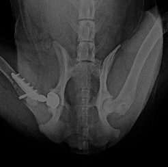 Abb 11 Zurich Cementless postoperativ. Primrstabilitt durch Verschraubung des Schaftes und Press-Fit der Pfanne