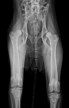 Abb 1 HD mit Luxation als Ursache der Hftarthrose (Coxarthrose)