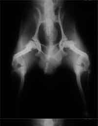 HD-und-Coxarthrose-extrem